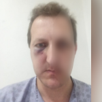 “Oğlumu qəddarlıqla döydülər” - Əməkdar artistdən oğlunu döyənlərin həbs edilməməsinə ETİRAZ